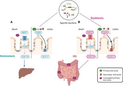 Frontiers Gut Microbiota Derived Metabolites In Irritable Bowel Syndrome